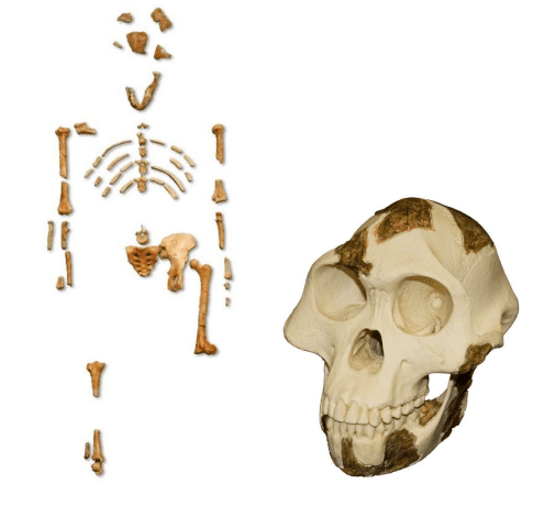 A skull and bones of an individual with the skeleton missing.